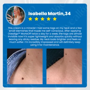 Oveallgo™ PRO WartsOff Instant Blemish Removal Cream