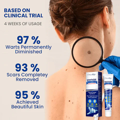 Oveallgo™ PRO WartsOff Instant Blemish Removal Cream