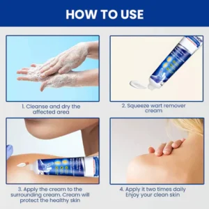 Oveallgo™ PRO WartsOff Instant Blemish Removal Cream