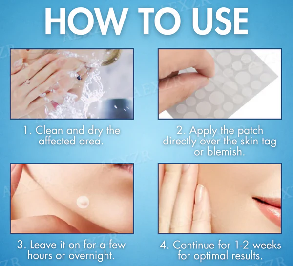 Skinetiv™ Moles & Warts Removing Skin Tag Patch