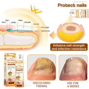 UNPREE™ Kolirin Bee Venom Nail Fungus Spray
