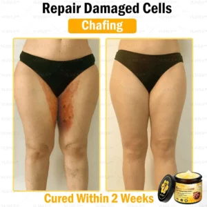 VLSVLS™ Bee Venom Skin Restoration Cream