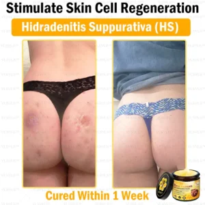VLSVLS™ Bee Venom Skin Restoration Cream