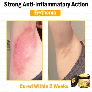 VLSVLS™ Bee Venom Skin Restoration Cream