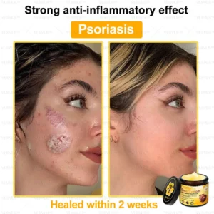 VLSVLS™ Bee Venom Skin Restoration Cream