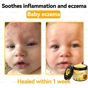VLSVLS™ Bee Venom Skin Restoration Cream