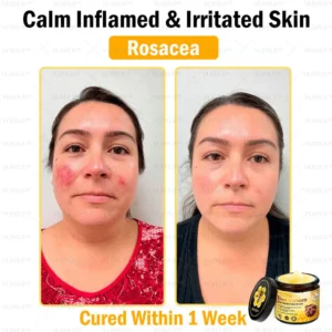 VLSVLS™ Bee Venom Skin Restoration Cream