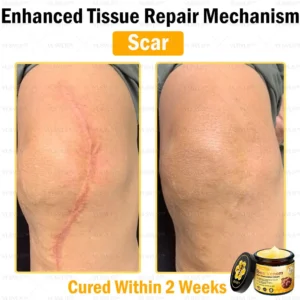 VLSVLS™ Bee Venom Skin Restoration Cream