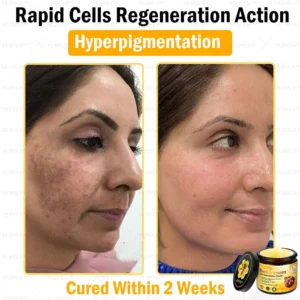 VLSVLS™ Bee Venom Skin Restoration Cream