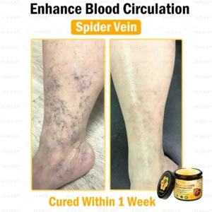 VLSVLS™ Bee Venom Skin Restoration Cream