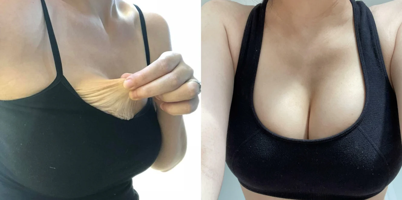 𝙀𝙙𝙞𝙅𝙤𝙣𝙖𝙝™ 𝑹𝒐𝒚𝒂𝒍 𝑱𝒆𝒍𝒍𝒚 𝑩𝒓𝒆𝒂𝒔𝒕 𝑬𝒏𝒉𝒂𝒏𝒄𝒆𝒎𝒆𝒏𝒕 𝑷𝒂𝒕𝒄𝒉
