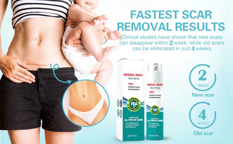 Advanced Scar Spray For All Types of Scars - For example Acne Scars, Surgical Scars and Stretch Marks