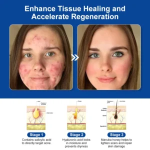 Bee Venom Skin Treatment Cream (AAD Recommended👨‍⚕️)