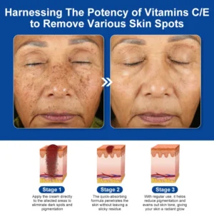 Bee Venom Skin Treatment Cream (AAD Recommended👨‍⚕️)