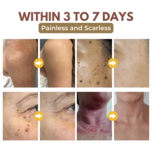 Biancat™ GlowRevive Skin Exfoliating Gel