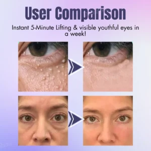Dobshow™ Collagen+ Bee Venom Eye Cream Roll On