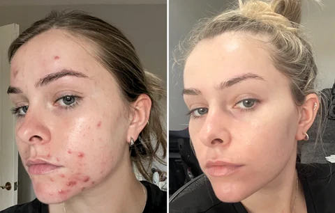 Dobshow™ SpotErase Trio Vitamin C 20% Removal Cream
