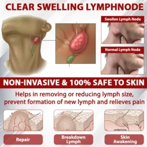 EdemaCare™ LymphDrain Horse Chestnut Massage Cream