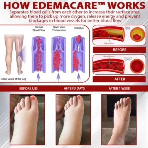 EdemaCare™ LymphDrain Horse Chestnut Massage Cream