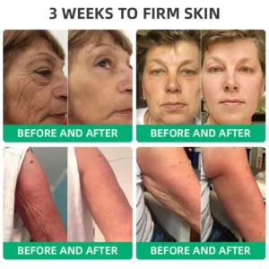 LOVILDS™ Wrinkle Removel Cream,Address Crepe & Sagging