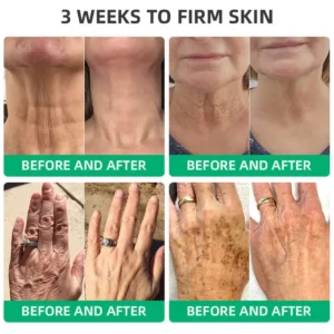 LOVILDS™ Wrinkle Removel Cream,Address Crepe & Sagging