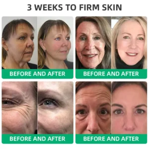 LOVILDS™ Wrinkle Removel Cream,Address Crepe & Sagging