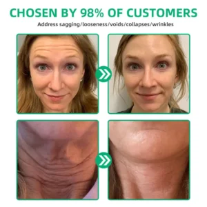 LOVILDS™ Wrinkle Removel Cream,Address Crepe & Sagging