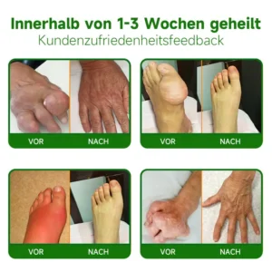 Ourlyard™ Extra Starker Hanfcreme👨‍⚕️Vom Deutsche Gesellschaft für Orthopädie und Unfallchirurgie (DGOU) genehmigt