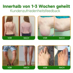 Ourlyard™ Extra Starker Hanfcreme👨‍⚕️Vom Deutsche Gesellschaft für Orthopädie und Unfallchirurgie (DGOU) genehmigt
