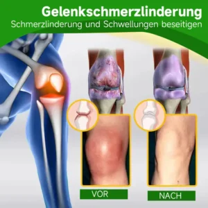 Ourlyard™ Extra Starker Hanfcreme👨‍⚕️Vom Deutsche Gesellschaft für Orthopädie und Unfallchirurgie (DGOU) genehmigt