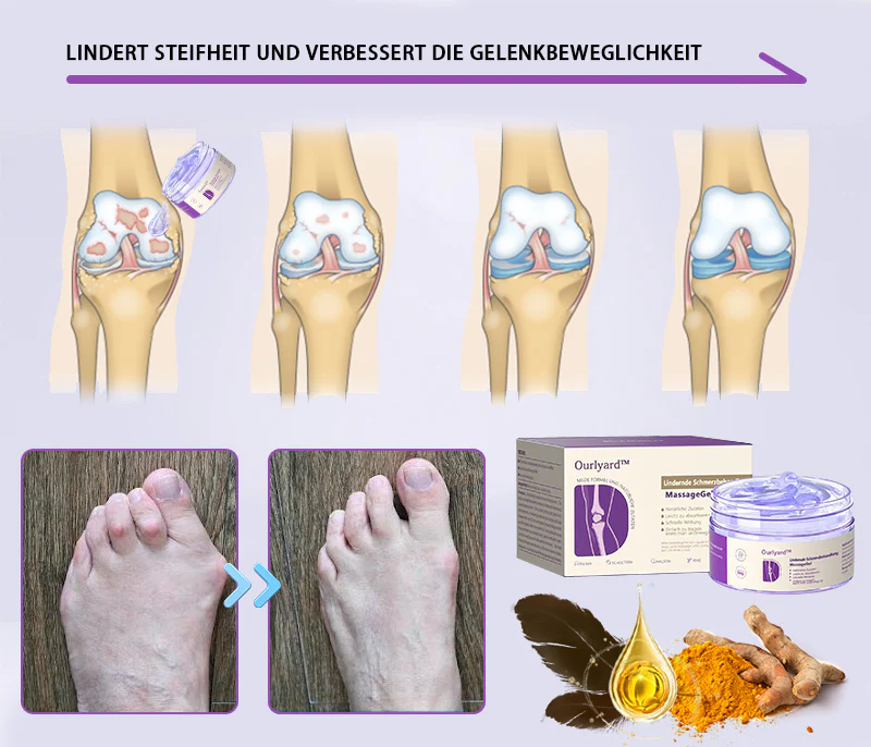 Ourlyard™ Kurkuma- & Emuöl-Gel zur Linderung von Arthritis-Schmerzen 👨‍⚕️ Zertifiziert von der Deutschen Gesellschaft für Orthopädie und Unfallchirurgie (DGOU)