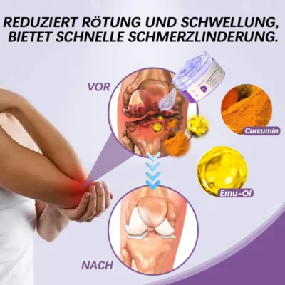 Ourlyard™ Kurkuma- & Emuöl-Gel zur Linderung von Arthritis-Schmerzen 👨‍⚕️ Zertifiziert von der Deutschen Gesellschaft für Orthopädie und Unfallchirurgie (DGOU)