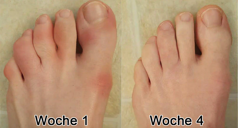 Ourlyard™ Kurkuma- & Emuöl-Gel zur Linderung von Arthritis-Schmerzen 👨‍⚕️ Zertifiziert von der Deutschen Gesellschaft für Orthopädie und Unfallchirurgie (DGOU)