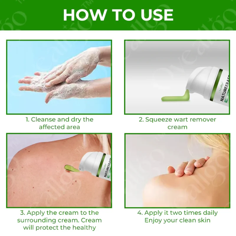 Oveallgo™ EX NatureErase Instant Mole & Spot Cream