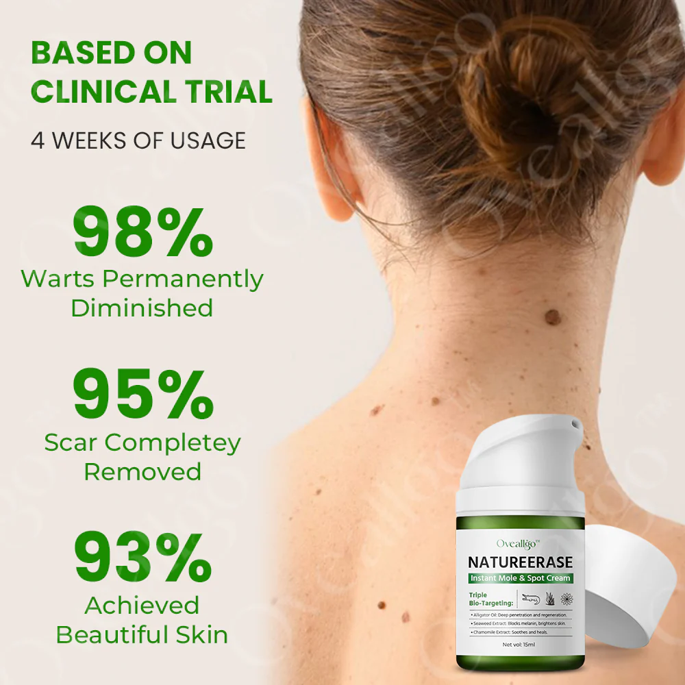 Oveallgo™ SUPER NatureErase Instant Mole & Spot Cream