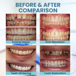 Winter Sale Beezau™ Bee Venom Teeth Restoration Powder
