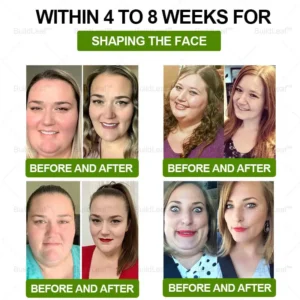 𝐁𝐮𝐢𝐥𝐝𝐋𝐞𝐚𝐟® 𝐓𝐢𝐫𝐳𝐞𝐩𝐚𝐭𝐢𝐝𝐞 𝐆𝐋𝐏-𝟏 𝐇𝐞𝐫𝐛𝐚𝐥 𝐎𝐫𝐚𝐥 𝐋𝐢𝐪𝐮𝐢𝐝 𝐓𝐚𝐫𝐠𝐞𝐭𝐬: 𝐎𝐛𝐞𝐬𝐢𝐭𝐲, 𝐋𝐲𝐦𝐩𝐡𝐞𝐝𝐞𝐦𝐚, 𝐃𝐢𝐚𝐛𝐞𝐭𝐞𝐬, 𝐂𝐚𝐫𝐝𝐢𝐨𝐯𝐚𝐬𝐜𝐮𝐥𝐚𝐫 𝐝𝐢𝐬𝐞𝐚𝐬𝐞, 𝐇𝐢𝐠𝐡 𝐛𝐥𝐨𝐨𝐝 𝐩𝐫𝐞𝐬𝐬𝐮𝐫𝐞, 𝐅𝐚𝐭𝐭𝐲 𝐥𝐢𝐯𝐞𝐫, 𝐚𝐧𝐝 𝐆𝐮𝐭 𝐡𝐞𝐚𝐥𝐭𝐡 𝐢𝐬𝐬𝐮𝐞𝐬
