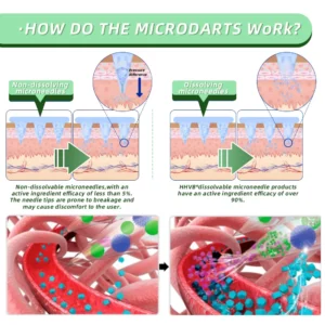 𝐇𝐇𝐕𝐁® 𝐒𝐌𝐆𝐓-𝐆𝐋𝐏-𝟏 𝐍𝐚𝐧𝐨 𝐌𝐢𝐜𝐫𝐨𝐧𝐞𝐞𝐝𝐥𝐞 𝐏𝐚𝐭𝐜𝐡