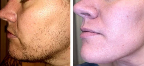 AEXZR® Instant Hair Removal Cream Kit