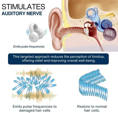 AEXZR™ Ear Acupoint Tinnitus Relief