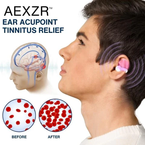 AEXZR™ Ear Acupoint Tinnitus Relief