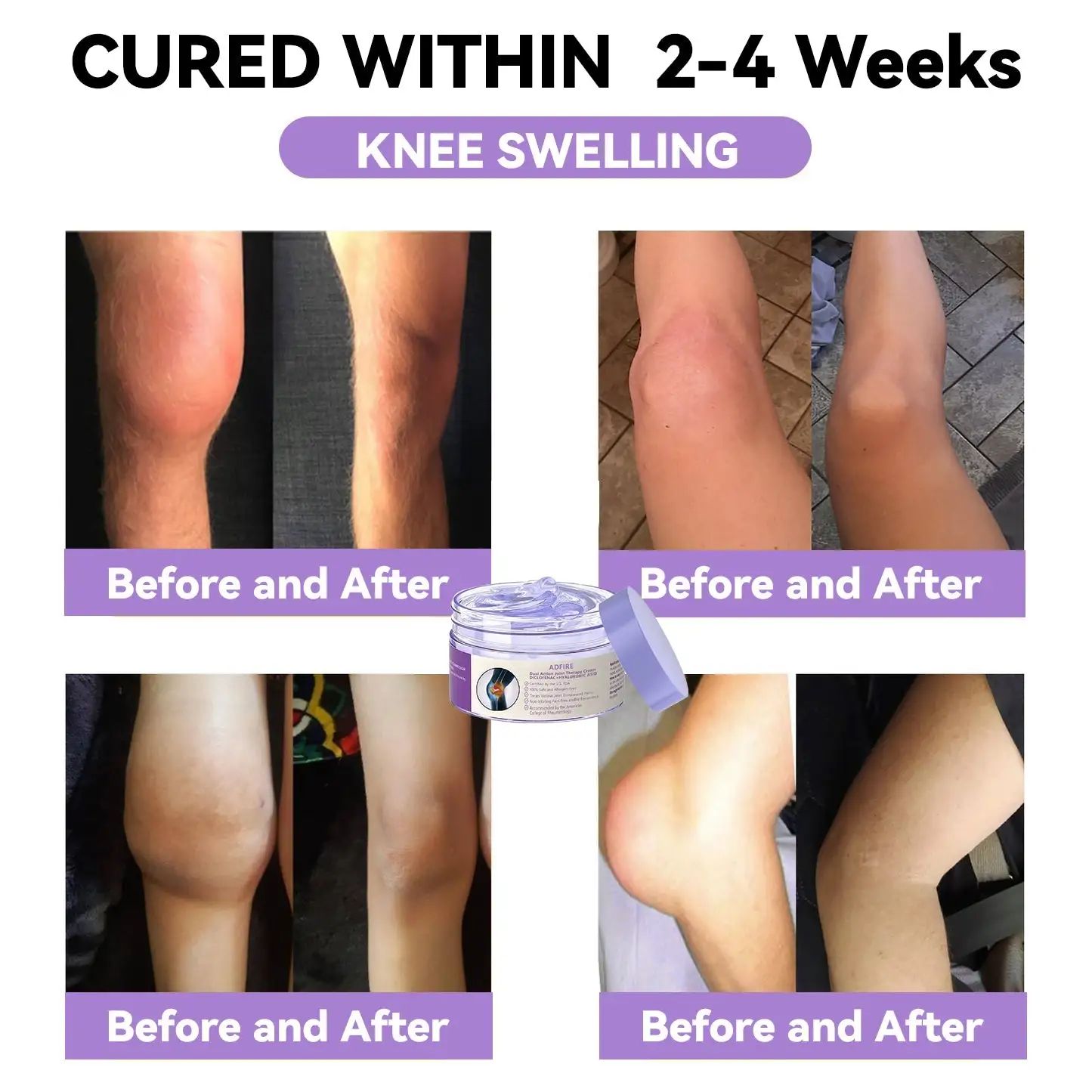 BBOJI® 7 Day Rapid Joint & Bone Therapy Cream USA Orthopedics (AAOS) Approved