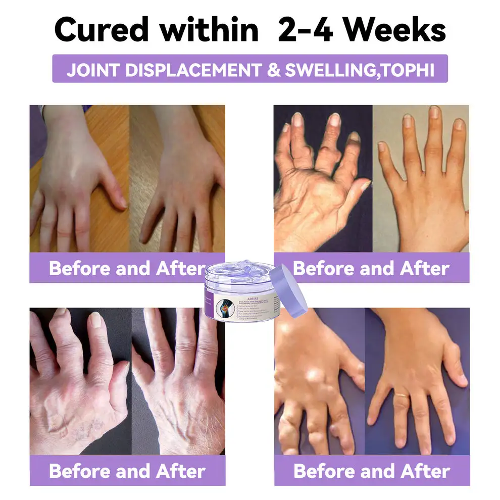 BBOJI® 7 Day Rapid Joint & Bone Therapy Cream USA Orthopedics (AAOS) Approved