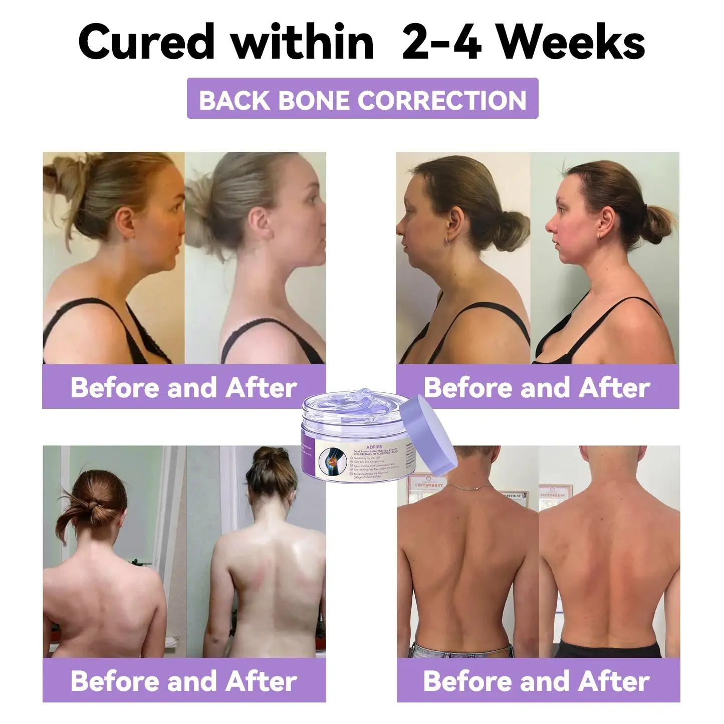 BBOJI® 7 Day Rapid Joint & Bone Therapy Cream USA Orthopedics (AAOS) Approved