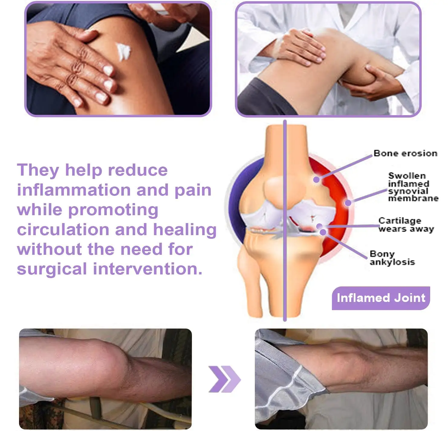 BBOJI® 7 Day Rapid Joint & Bone Therapy Cream USA Orthopedics (AAOS) Approved