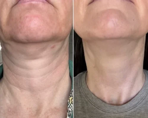 Biancat® BeeLixir Neck Firming Stick