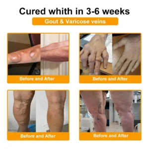 Botulinum Toxin & Bee Venom Orthopedic Relief Cream