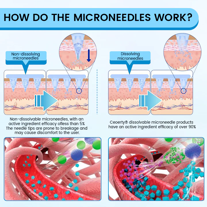 Ceoerty® GlucaLite GLP-1 Nano Microneedle Patch