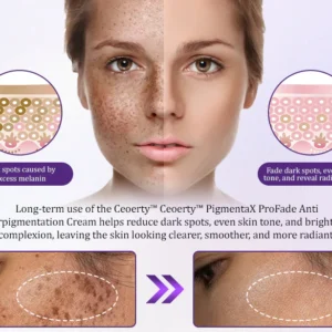 Ceoerty® PigmentaX ProFade Anti-Hyperpigmentation Cream