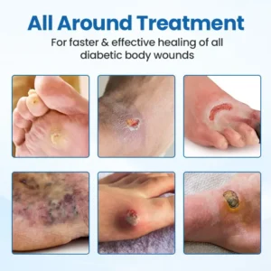 Czticle® DiabeHeal Skin Recovery Band